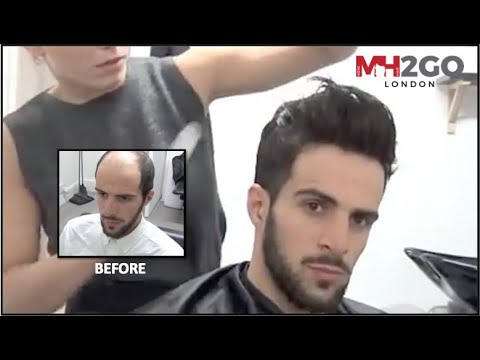 Hair Replacement FITTING VIDEO (Sam) – Hair loss, Baldness, Hair Wigs, Hair Toupees, Hair pieces - YouTube