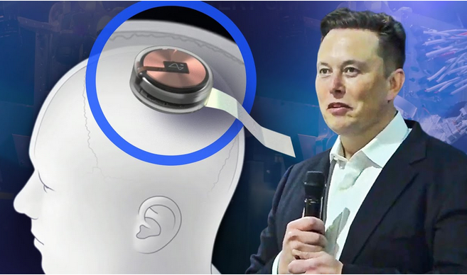 Elon Musk Hopes to Test a Brain Implant in Humans Next Year - The New York Times