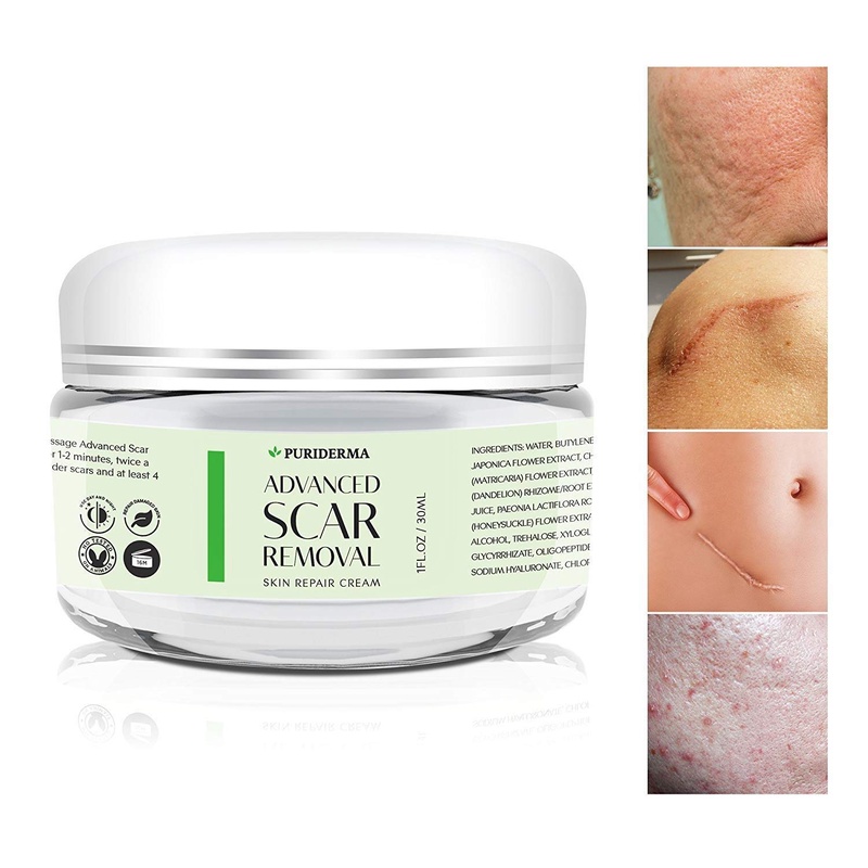 Amazon.com: Scar Removal Cream - Advanced Treatment for Face & Body, Old & New Scars from Cuts, Stretch Marks, C-Sections & Surgeries - With Natural Herbal Extracts Formula - (30 ml): Beauty